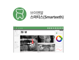 스마티스(Smarteeth)